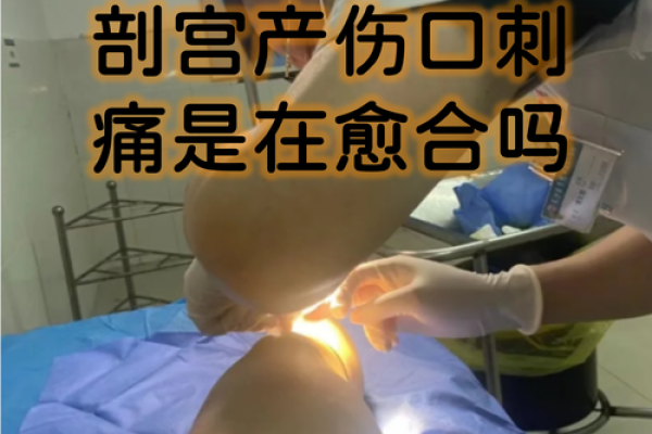 26年7月21日适合剖腹产吗